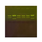DNA Fingerprinting by Restriction Enzyme Patterns w/ SYBR Safe DNA Stain